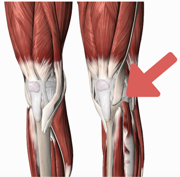 knee anatomy image pointing to the ITB insertion point 