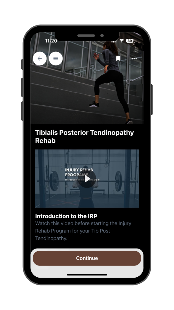 iphone mock up of a screenshot of the Tib Post Tendon rehab program on HanPhysio app Ripple