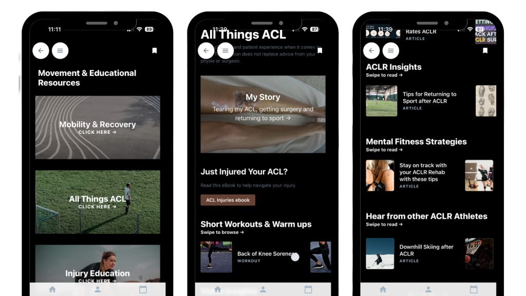 3 iphone screens showing the ACL injury pages in my app